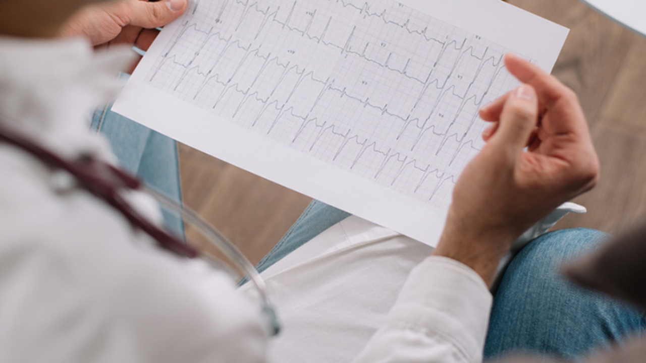 Electrocardiograma IA