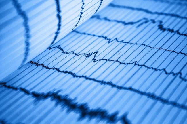 Inteligencia artificial ECG