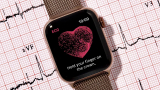 La función de electrocardiograma (ECG) llega al Apple Watch Series 4